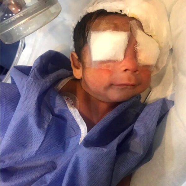 1col-baby-eye-gauze